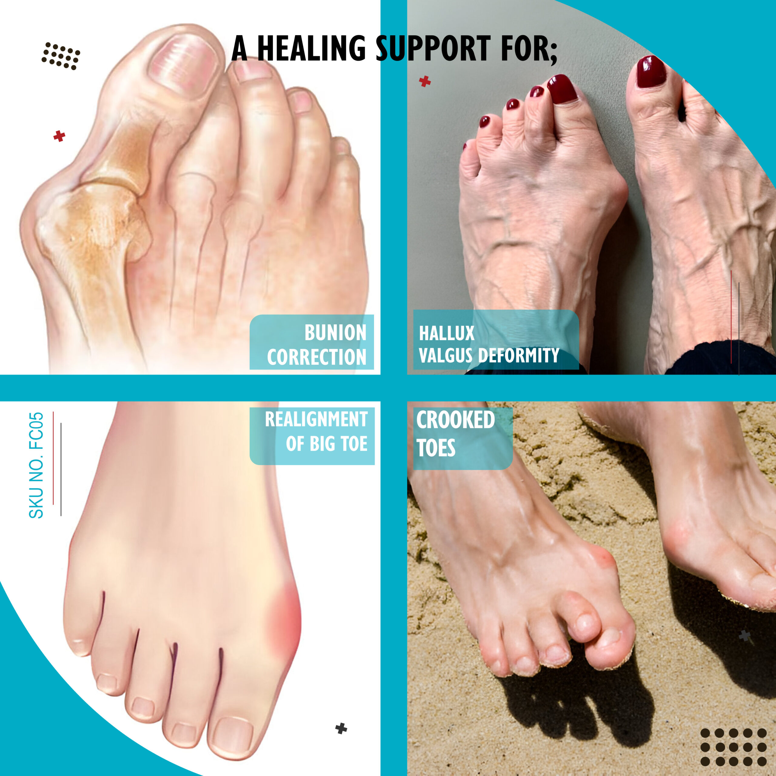SKU:FC05 - Bunion Support - Image 3